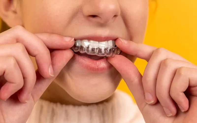 Odontología Preventiva
